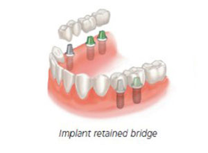 Goyal Implants Centre Jalandhar