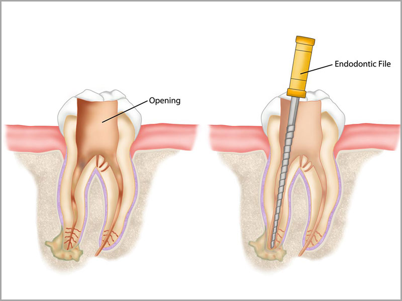 Goyal Dental Clinic Centre in Jalandhar Punjab